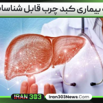 ابتلا به بیماری کبد چرب قابل شناسایی شد
