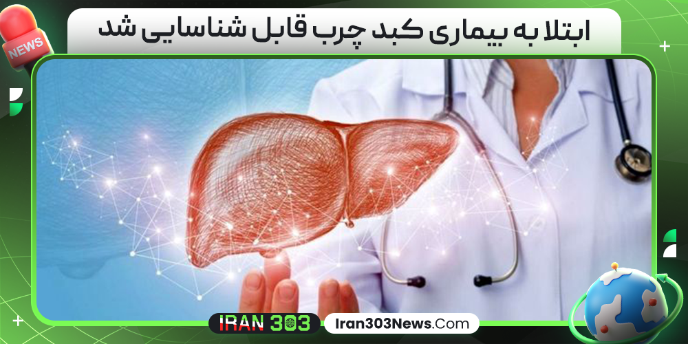 ابتلا به بیماری کبد چرب قابل شناسایی شد